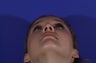 Revision Rhinoplasty