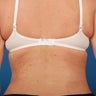 40 - 50 Year Old Female