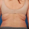 40 - 50 Year Old Female