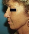 41 year old female patient