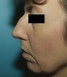 41 year old female patient