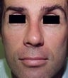 44 year old male patient