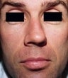 44 year old male patient