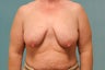 59 year old female, 5'1, 161 lbs