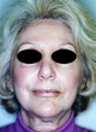 60 year old female patient
