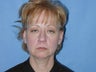 55 year old woman who was unhappy with her appearance