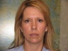 Blepharoplasty
