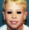 10 year old male patient