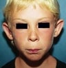 10 year old male patient