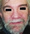 57 year old male patient
