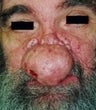 57 year old male patient