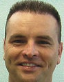 FUE-BHT hair transplantation using head and body hair