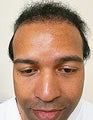 UE – BHT by SFET Using Beard and Chest Hair