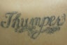 Laser Tattoo Removal