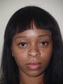 Rhinoplasty