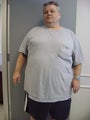 Gastric Bypass