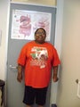 Gastric Bypass
