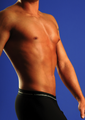 Tummy Liposuction