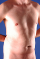 Tummy Liposuction