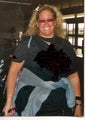 Gastric Bypass