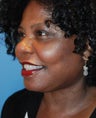 Face Lift, Neck Lift, Neck Liposuction