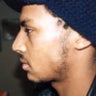 African American Rhinoplasty