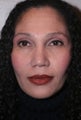 African American Rhinoplasty