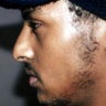 African American Rhinoplasty