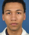 African American Rhinoplasty
