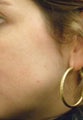 Before and After Photos From Jason R. Lupton, M.D.