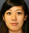 Rhinoplasty