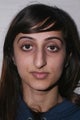 Asian Rhinoplasty