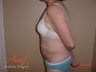 Body Jet