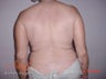 Body Jet