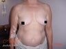 Body Jet