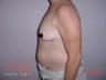 Body Jet