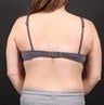 Bra Line Back Lift