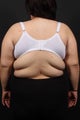 Bra Line Back Lift