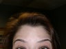 Botox