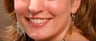 Botox for a gummy smile