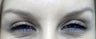BOTOX Cosmetic