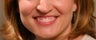 Botox for a gummy smile