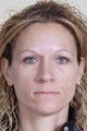 Botox and Restylane