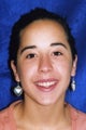 Orthodontic braces with miniscrew anchorage