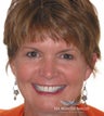 Six Month Smile/ Short term orthodontics