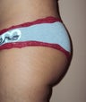 Butt implant augmentation