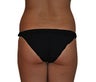 Butt Augmentation (Implants)