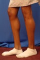 33 year old wanting calf implants