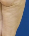 Cellulaze
