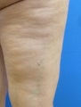 Cellulaze